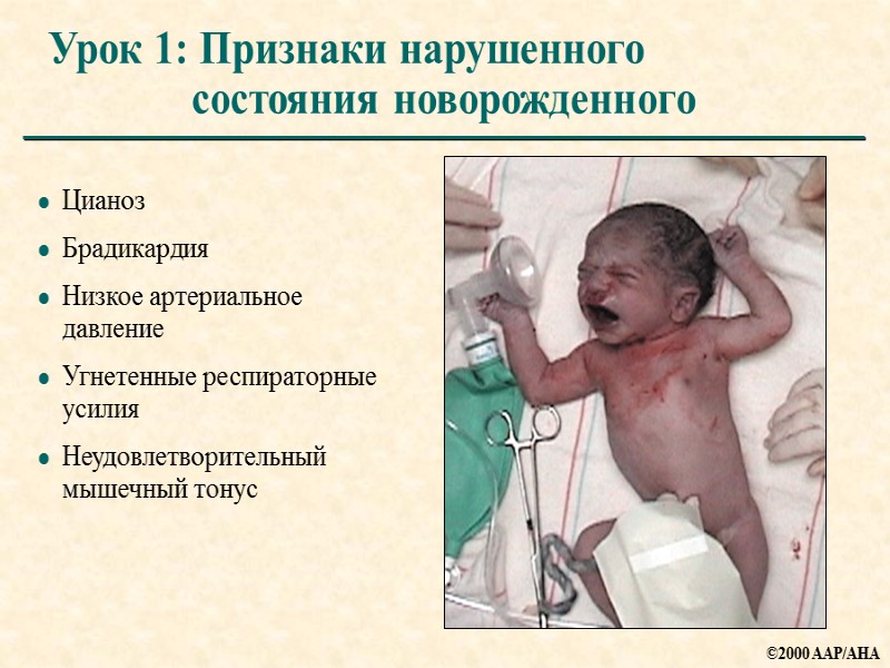 Урок 1: Признаки нарушенного состояния новорожденного Цианоз Брадикардия Низкое артериальное давление Угнетенные респираторные усилия